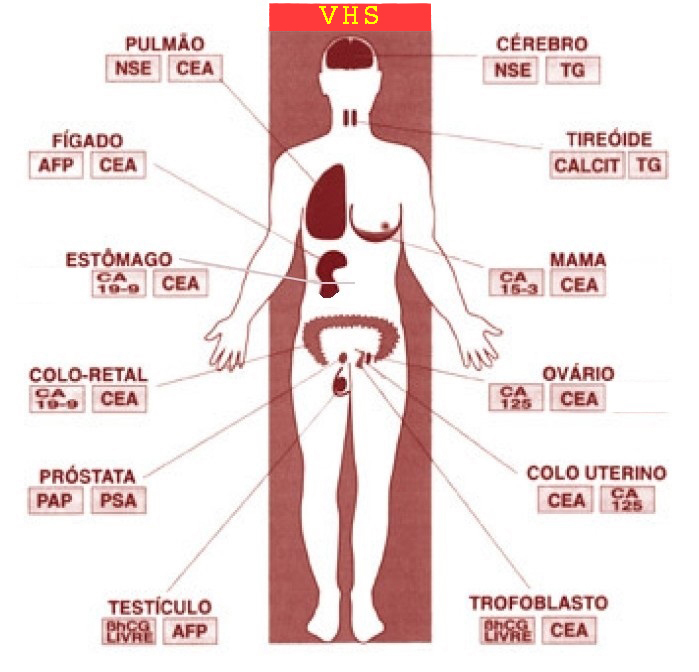 Exame de Sangue - CA 125 20/09/2011