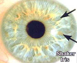 Shaker Iris